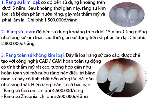 http://nhakhoa126.com/hinhanh/Gioi-thieu/nhakhoa126-bang-gia-rang-su.jpg