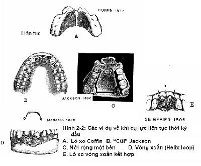 http://nhakhoa126.com/hinhanh/chinh%20nha/lich-su-chinh-nha02.jpg