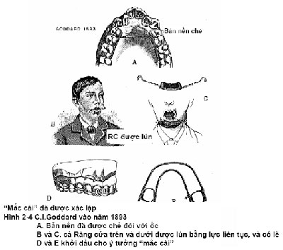 http://nhakhoa126.com/hinhanh/chinh%20nha/lich-su-chinh-nha03.jpg