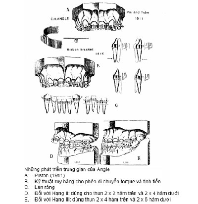 http://nhakhoa126.com/hinhanh/chinh%20nha/lich-su-chinh-nha04.jpg