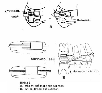 http://nhakhoa126.com/hinhanh/chinh%20nha/lich-su-chinh-nha06.jpg