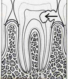 http://nhakhoa126.com/hinhanh/hinh-ve/Saurang14.jpg